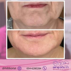 331446689_607054144091753_8082730210232745447_n